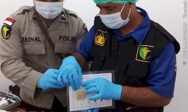 Sidokkes-Polres-Malaka-Pastikan-Menu-MBG-di-SPPG-Kemala-Bhayangkari-Aman-dan-Layak-Konsumsi